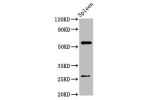 Western Blot<br />
Positive WB detected in:Mouse spleen tissue<br />
All lanes:ACD antibody at 4