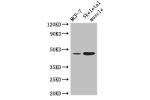 Western Blot<br />
Positive WB detected in:MCF-7 whole cell lysate,Mouse skeletal muscle tissue<br />
All lanes: ARRDC3 antibody at 4ug/ml<br />
Secondary<br />
Goat polyclonal to rabbit IgG at 1/50000 dilution<br />
Predicted band size: 47 kDa<br />
Obse