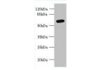 Western blot<br />
All lanes: FAM149B1 antibody at 3ug/ml+ Mouse liver tissue<br />
Goat polyclonal to rabbit at 1/10000 dilution<br />
Predicted band size: 65,59 kDa<br />
Observed band size: 65 kDa<br />