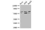 Western Blot<br />
Positive WB detected in:Hela whole cell lysate,A549 whole cell lysate,HepG2 whole cell lysate<br />
All lanes:ADCK4 antibody at 3