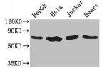 Western Blot<br />
Positive WB detected in:HepG2 whole cell lysate,Hela whole cell lysate,Jurkat whole cell lysate,Mouse heart tissue<br />
All lanes: CHFR antibody at 3.2ug/ml<br />
Secondary<br />
Goat polyclonal to rabbit IgG at 1/50000000 dilution<br 