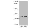 Western blot<br />
All lanes: