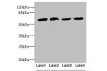 Western blot<br />
All lanes: CEP63 antibody at 12ug/ml<br />
Lane 1 : K562 whole cell lysate<br />
Lane 2 : Hela whole cell lysate<br />
Lane 3 : NIH/3T3 whole cell lysate<br />
Lane 4 : Raji whole cell lysate<br />
Secondary<br />
Goat polyclonal to Rab