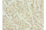 Immunohistochemistry of paraffin-embedded human lung tissue using CSB-PA839788ESR2HU at dilution 1:100