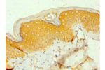 Immunohistochemistry of paraffin-embedded human skin using CSB-PA839816ESR2HU at dilution 1:100