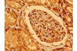 Immunohistochemistry of paraffin-embedded human kidney tissue using CSB-PA839862LA01HU at dilution of 1:100
