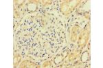 Immunohistochemistry of paraffin-embedded human kidney tissue using CSB-PA840564LA01HU at dilution of 1:100