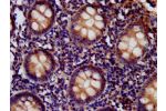 IHC image of CSB-PA840569LA01HU diluted at 1:400 and staining in paraffin-embedded human appendix tissue performed on a Leica BondTM system.