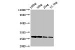 Western Blot<br />
Positive WB detected in Recombinant protein<br />
All lanes:albA antibody at 3.4