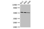 Western Blot<br />
Positive WB detected in:Raji whole cell lysate,K562 whole cell lysate,A549 whole cell lysate<br />
All lanes:BLNK antibody at 2.7
