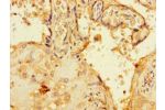 Immunohistochemistry of paraffin-embedded human placenta tissue using CSB-PA840992LA01HU at dilution of 1:100