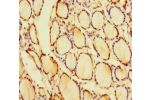 Immunohistochemistry of paraffin-embedded human thyroid tissue using CSB-PA841000LA01HU at dilution of 1:100