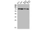 Western blot analysis of varias lysis using F13B antibody. Antibody was diluted at 1:2000. Secondary antibody  was diluted at 1:20000