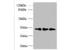 Western blot<br />
All lanes: RQCD1 antibody at 6ug/ml<br />
Lane 1 : HepG-2 whole cell lysate<br />
Lane 2 : Mouse small intestine tissue<br />
Lane 3 : Mouse spleen tissue<br />
Secondary<br />
Goat polyclonal to Rabbit IgG at 1/10000 dilution<br />
Pre