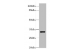 Western blot<br />
All lanes:ERGIC1 antibody at 2ug/ml+HepG2 whole cell lysate<br />
Secondary<br />
Goat polyclonal to rabbit at 1/10000 dilution<br />
Predicted band size: 33,23,18 kDa<br />
Observed band size: 33 kDa<br />