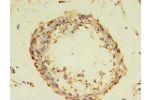 Immunohistochemistry of paraffin-embedded human testis using CSB-PA842645LA01HU at dilution 1:100