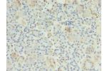 Immunohistochemistry of paraffin-embedded human pancreatic tissue using CSB-PA842657LA01HU at dilution of 1:100