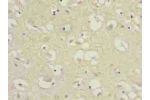 Immunohistochemistry of paraffin-embedded human brain tissue using CSB-PA842660LA01HU at dilution of 1:100