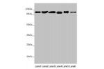 Western blot<br />
All lanes:DHTKD1 antibody at 1.82 ug/ml<br />
Lane 1 : Mouse heart tissue<br />
Lane 2 : Mouse liver tissue<br />
Lane 3 : Mouse kidney tissue<br />
Lane 4 : A431 whole cell lysate<br />
Lane 5 : MCF7 whole cell lysate<br />
Lane 6 : He