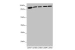 Western blot<br />
All lanes:DHTKD1 antibody at 1.81 ug/ml<br />
Lane 1 : Mouse liver tissue<br />
Lane 2 : Mouse kidney tissue<br />
Lane 3 : A431 whole cell lysate<br />
Lane 4 : MCF7 whole cell lysate<br />
Lane 5 : HepG-2 whole cell lysate<br />
Secon