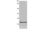 Western blot<br />
All lanes: ABHD14B antibody at 16ug/ml<br />
Lane 1 : Mouse small intestine tissue<br />
Lane 2 : Mouse spleen tissue<br />
Lane 3 : Mouse liver tissue<br />
Lane 4 : Mouse lung tissue<br />
Secondary<br />
Goat polyclonal to rabbit IgG