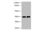 Western blot<br />
All lanes: FYTTD1 antibody at 4ug/ml<br />
Lane 1 : A375 whole cell lysate<br />
Lane 2 : Jurkat whole cell lysate<br />
Secondary<br />
Goat polyclonal to Rabbit IgG at 1/10000 dilution<br />
Predicted band size: 36,34,29,15 kDa<br />
