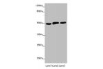 Western blot<br />
All lanes: CRBN antibody at 4.65 ug/ml<br />
Lane 1 : Mouse liver tissue<br />
Lane 2 : Colo320 whole cell lysate<br />
Lane 3 : A375 whole cell lysate<br />
Secondary<br />
Goat polyclonal to rabbit IgG at 1/10000 dilution<br />
Predic