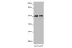 Western blot<br />
All lanes: CRBN antibody at 5.28 ug/ml<br />
Lane 1 : Mouse liver tissue<br />
Lane 2 : A375 whole cell lysate<br />
Secondary<br />
Goat polyclonal to rabbit IgG at 1/10000 dilution<br />
Predicted band size: 51 kDa<br />
Observed band