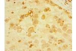 Immunohistochemistry of paraffin-embedded human placenta tissue using CSB-PA843134LA01HU at dilution of 1:100