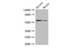 Western Blot<br />
Positive WB detected in:Mouse spleen tissue,Mouse brain tissue<br />
All lanes: D2HGDH antibody at 3ug/ml<br />
Secondary<br />
Goat polyclonal to rabbit IgG at 1/50000 dilution<br />
Predicted band size: 57,33,35 kDa<br />
Observed ban