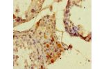 Immunohistochemistry of paraffin-embedded human testis tissue using CSB-PA843310HA01HU at dilution of 1:100