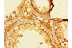 Immunohistochemistry of paraffin-embedded human testis tissue using CSB-PA843324LA01HU at dilution of 1:100