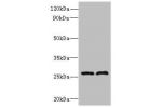 Western blot<br />
All lanes: FAM71C antibody at 6ug/ml<br />
Lane 1 : 293T whole cell lysate<br />
Lane 2 : Jurkat whole cell lysate<br />
Secondary<br />
Goat polyclonal to Rabbit IgG at 1/10000 dilution<br />
Predicted band size: 27 kDa<br />
Observed 