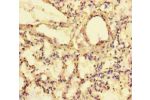 Immunohistochemistry of paraffin-embedded human lung tissue using CSB-PA843342LA01HU at dilution of 1:100