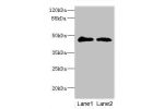 Western blot<br />
All lanes:GCNT2 antibody at 3.99ug/ml<br />
Lane 1:293T whole cell lysate<br />
Lane 2:mouse placenta tissue<br />
Secondary<br />
Goat polyclonal to rabbit at 1/10000 dilution<br />
Predicted band size: 46,47 kDa<br />
Observed band si