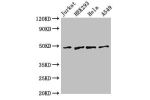 Western Blot<br />
Positive WB detected in:Jurkat whole cell lysate,HEK293 whole cell lysate,Hela whole cell lysate,A549 whole cell lysate<br />
All lanes:GABPB2 antibody at 2.5