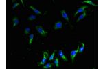 Immunofluorescent analysis of Hela cells using CSB-PA844708LA01HU at a dilution of 1:100 and Alexa Fluor 488-congugated AffiniPure Goat Anti-Rabbit IgG(H+L)