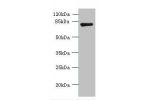 Western blot<br />
All lanes: FBXO30 antibody at 10ug/ml+ Mouse brain tissue<br />
Goat polyclonal to rabbit at 1/10000 dilution<br />
Predicted band size: 82 kDa<br />
Observed band size: 82 kDa<br />