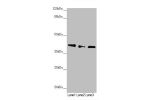 Western blot<br />
All lanes:DYNC2LI1 antibody at 1.17 ug/ml<br />
Lane 1 : 293T whole cell lysate<br />
Lane 2 : A549 whole cell lysate<br />
Lane 3 : Mouse gonadal tissue<br />
Secondary<br />
Goat polyclonal to rabbit IgG at 1/10000 dilution<br />
Pred