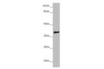 Western blot<br />
All lanes:DYNC2LI1 antibody at 1.06 ug/ml+ Mouse gonadal tissue<br />
Secondary<br />
Goat polyclonal to rabbit IgG at 1/10000 dilution<br />
Predicted band size: 40,38,23,16 kDa<br />
Observed band size: 40 kDa<br />