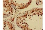 Immunohistochemistry of paraffin-embedded human testis tissue using CSB-PA844735LA01HU at dilution of 1:100