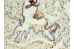 Immunohistochemistry of paraffin-embedded human lung tissue using CSB-PA845142EA01HU at dilution 1:100