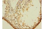 Immunohistochemistry of paraffin-embedded human testis tissue CSB-PA845159LA01HU at dilution 1:100