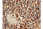 Immunohistochemistry of paraffin-embedded human spleen tissue using CSB-PA845172LA01HU at dilution of 1:100