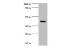 Western blot<br />
All lanes:ATG4A antibody at 2ug/ml+mouse brain tissue<br />
Secondary<br />
Goat polyclonal to rabbit at 1/10000 dilution<br />
Predicted band size: 46,39,37,43 kDa<br />
Observed band size: 45 kDa<br />