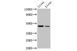 Western Blot<br />
Positive WB detected in:Mouse liver tissue,Rat liver tissue<br />
All lanes:DDB2 antibody at 4.9