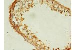 Immunohistochemistry of paraffin-embedded human testis tissue using CSB-PA846076LA01HU at dilution of 1:100