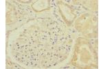 Immunohistochemistry of paraffin-embedded human kidney tissue CSB-PA846077ESR1HU at dilution 1:100