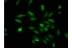 Immunofluorescence staining of Hela cells with CSB-PA846106LA01HU at 1:100,counter-stained with DAPI. The cells were fixed in 4% formaldehyde, permeabilized using 0.2% Triton X-100 and blocked in 10% normal Goat Serum. The cells were then incubated with t