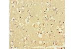 Immunohistochemistry of paraffin-embedded human brain tissue using CSB-PA846113LA01HU at dilution of 1:100